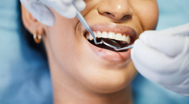 Best Emergency Root Canal Treatment in Lemmon, SD