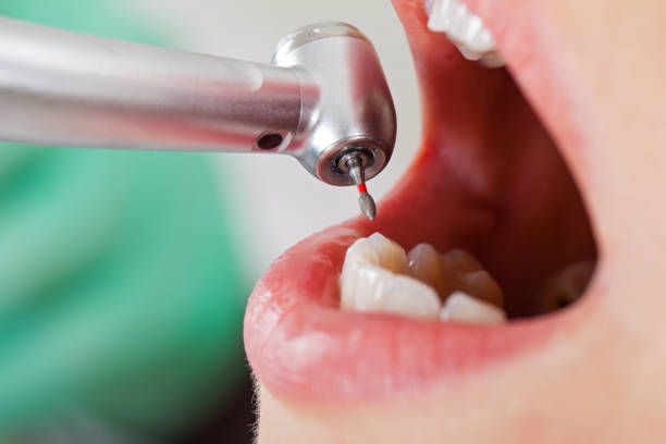 Best Emergency Treatment for Toothache in Lemmon, SD
